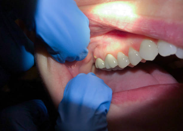Best Teeth Whitening  in Mahnomen, MN